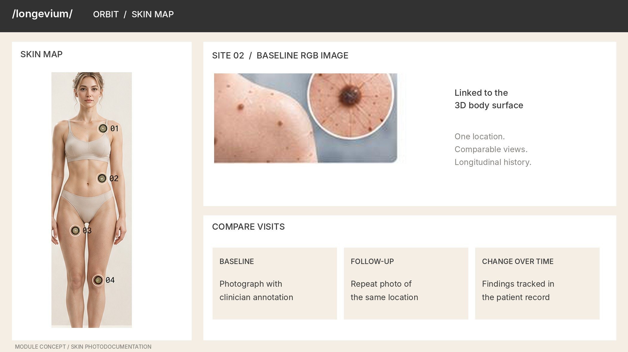 Mole map: the same skin spot photographed at two visits